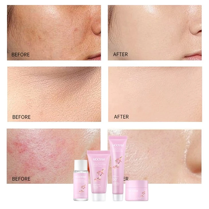 Sakura Brightening Skin Travel Kit